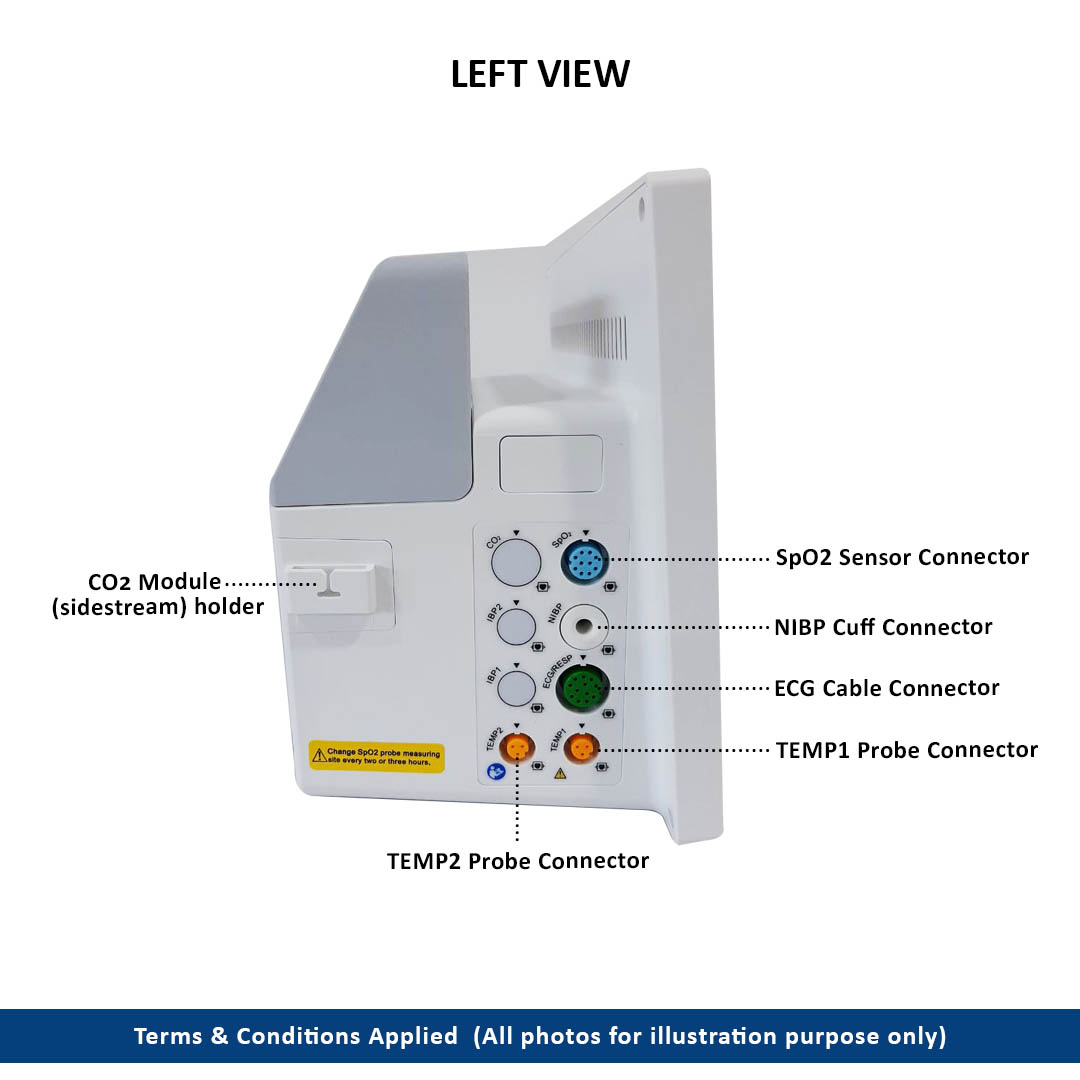 X1 Patient Monitor 2