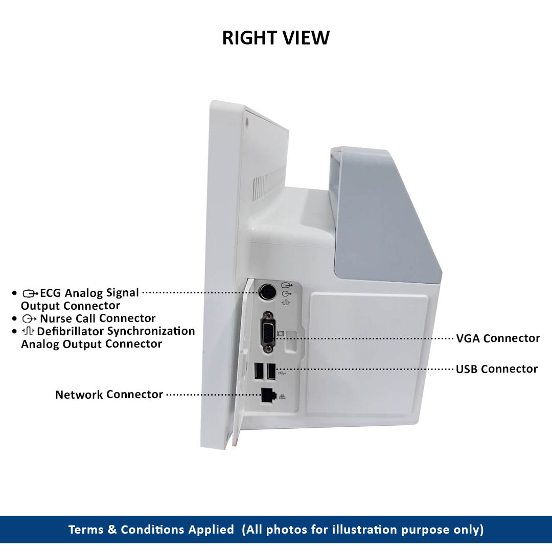 X1 Patient Monitor 3